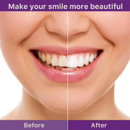 Bright Smile Powder